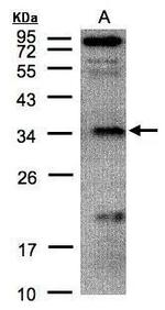 FN3KRP Polyclonal Antibody