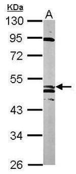 GABRB1 Antibody in Western Blot (WB)