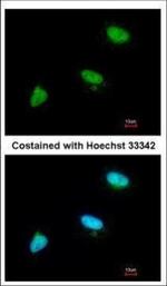 Cdc34 Antibody in Immunocytochemistry (ICC/IF)