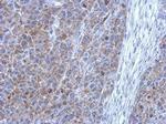 FGFR4 Antibody in Immunohistochemistry (Paraffin) (IHC (P))