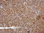 FGFR4 Antibody in Immunohistochemistry (Paraffin) (IHC (P))