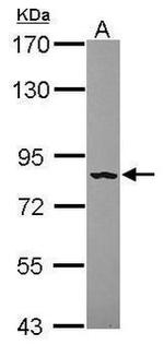 FGFR4 Antibody in Western Blot (WB)