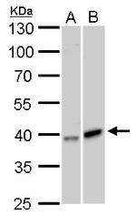 GALK1 Polyclonal Antibody