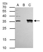 GTF2E2 Antibody in Immunoprecipitation (IP)