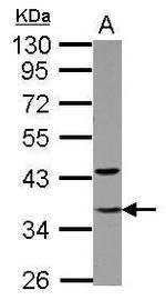 GTF2E2 Polyclonal Antibody