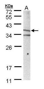 MICA Antibody in Western Blot (WB)