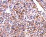 SLC20A1 Antibody in Immunohistochemistry (Paraffin) (IHC (P))