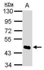 HDAC8 Antibody in Western Blot (WB)
