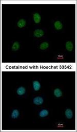 MAD1 Antibody in Immunocytochemistry (ICC/IF)