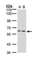 GABRA5 Antibody in Western Blot (WB)