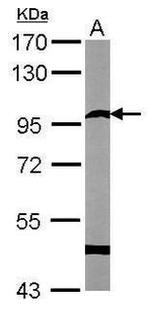 SEMA6A Antibody in Western Blot (WB)
