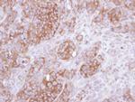 UST Polyclonal Antibody