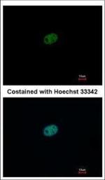 RFC2 Polyclonal Antibody