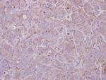 MAGEB1 Polyclonal Antibody