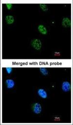 MAPKAPK3 Polyclonal Antibody
