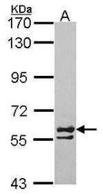 TCP-1 zeta Antibody in Western Blot (WB)