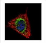 ETFA Polyclonal Antibody