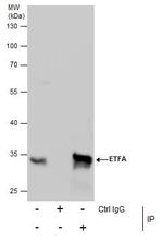 ETFA Antibody in Immunoprecipitation (IP)