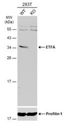 ETFA Antibody in Western Blot (WB)