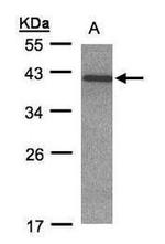 CDK20 Antibody in Western Blot (WB)