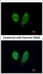 DDX1 Polyclonal Antibody