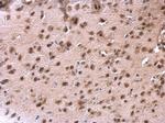 DDX1 Antibody in Immunohistochemistry (Paraffin) (IHC (P))