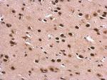 DDX1 Antibody in Immunohistochemistry (Paraffin) (IHC (P))