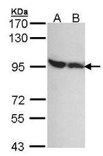 DDX1 Antibody in Western Blot (WB)