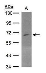 PIP5K1A Antibody in Western Blot (WB)