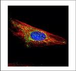 HK1 Antibody in Immunocytochemistry (ICC/IF)