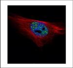 PP1 alpha Polyclonal Antibody