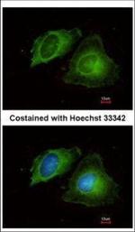 MMP17 Polyclonal Antibody