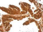 MMP17 Antibody in Immunohistochemistry (Paraffin) (IHC (P))
