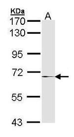 MMP17 Antibody in Western Blot (WB)