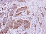 NDUFS1 Polyclonal Antibody