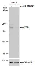 ZEB1 Antibody in Western Blot (WB)