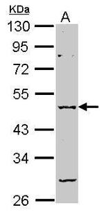 GABRA2 Polyclonal Antibody