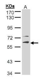 STK33 Polyclonal Antibody