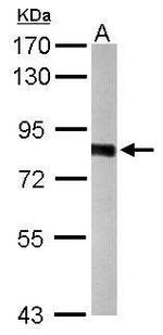 PWP2 Polyclonal Antibody