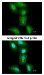 PSMC5 Polyclonal Antibody