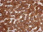 LSS Polyclonal Antibody