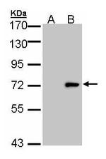 ULK4 Antibody in Western Blot (WB)