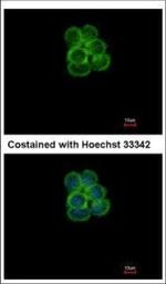 SGLT1 Antibody in Immunocytochemistry (ICC/IF)