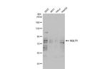 SGLT1 Antibody in Western Blot (WB)