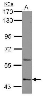 ASIC1 Antibody in Western Blot (WB)