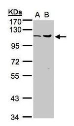 USP5 Antibody in Western Blot (WB)