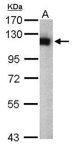 USP5 Antibody in Western Blot (WB)
