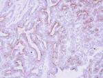 CDO Polyclonal Antibody