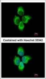 MMP8 Polyclonal Antibody