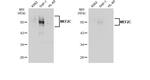 MEF2C Antibody in Western Blot (WB)